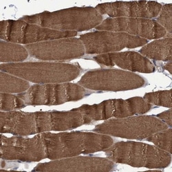NARG1 Antibody, Novus Biologicals 0.1mL; Unlabeled:Antibodies, Polyclonal