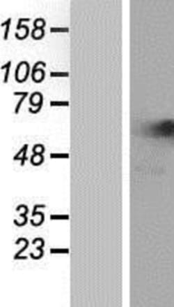 Novus Biologicals&trade;&nbsp;NARS Overexpression Lysate