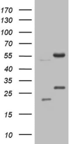 NARS2 Antibody (OTI10C10), Novus Biologicals 0.1mL; Unlabeled:Antibodies,