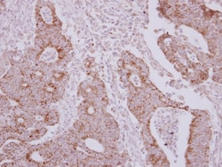 NARS2 Antibody, Novus Biologicals 0.1mL; Unlabeled:Antibodies, Polyclonal