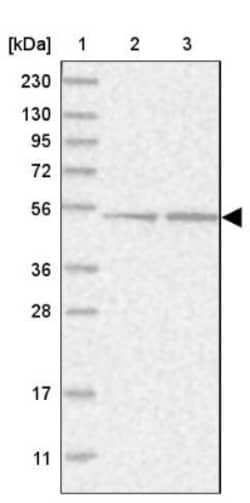 NARS2 Antibody, Novus Biologicals:Antibodies:Primary Antibodies
