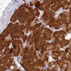 NARS Antibody, Novus Biologicals:Antibodies:Primary Antibodies