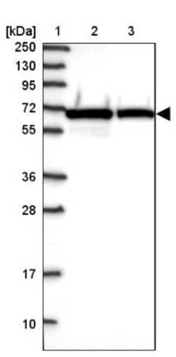NARS Antibody, Novus Biologicals:Antibodies:Primary Antibodies