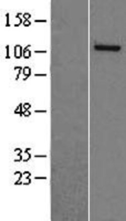 Novus Biologicals&trade;&nbsp;NASP Overexpression Lysate