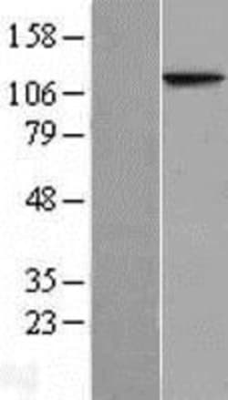 Novus Biologicals&trade;&nbsp;NAT10 Overexpression Lysate