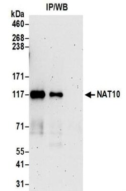 NAT10 Antibody, Novus Biologicals 0.1mg; Unlabeled:Antibodies, Polyclonal