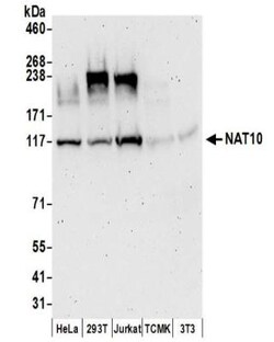 NAT10 Antibody, Novus Biologicals 0.1mg; Unlabeled:Antibodies, Polyclonal