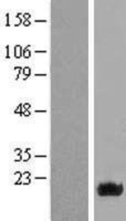 Novus Biologicals&trade;&nbsp;NAT13 Overexpression Lysate