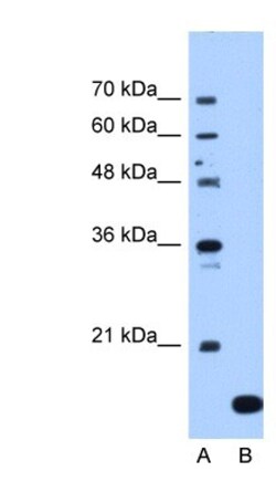 NAT13 Antibody, Novus Biologicals 0.1mg; Unlabeled:Antibodies, Polyclonal