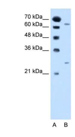 NAT2 Antibody, Novus Biologicals:Antibodies:Primary Antibodies