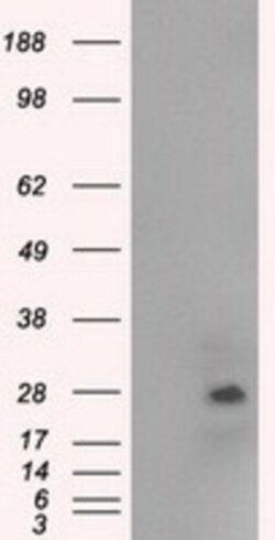 NAT8 Antibody (OTI5A8), Novus Biologicals 0.1 mL | Buy Online | Novus Biologicals | Fisher Scientific