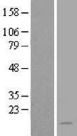 Novus Biologicals&trade;&nbsp;NAT8L Overexpression Lysate