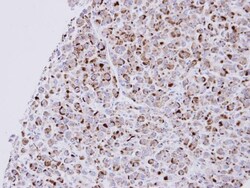 Natriuretic Peptide Receptor C Antibody, Novus Biologicals 0.1mg; Unlabeled:Antibodies,