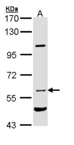 Natriuretic Peptide Receptor C Antibody, Novus Biologicals 0.1mg; Unlabeled:Antibodies,