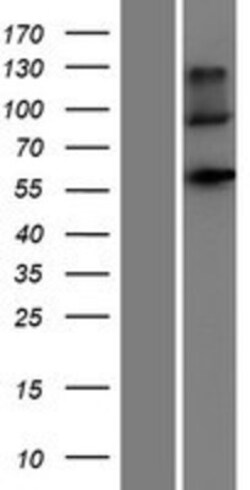 Novus Biologicals&trade;&nbsp;Natriuretic Peptide Receptor C Overexpression Lysate