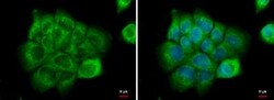 Natriuretic Peptide Receptor C Antibody, Novus Biologicals 0.1mg; Unlabeled:Antibodies,