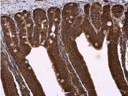 Natriuretic Peptide Receptor C Antibody, Novus Biologicals 0.1mg; Unlabeled:Antibodies,