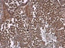 Natriuretic Peptide Receptor C Antibody, Novus Biologicals 0.1mg; Unlabeled:Antibodies,
