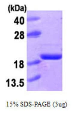 Novus Biologicals&trade;&nbsp;Recombinant Human LMW-PTP/ACP1 His Protein