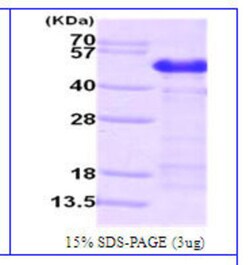 Novus Biologicals&trade;&nbsp;Recombinant Human Calumenin His Protein