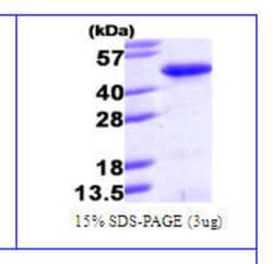 Novus Biologicals&trade;&nbsp;Recombinant Human PINX1 His Protein