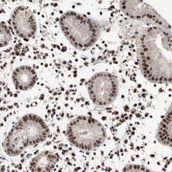 DAN/NBL1 Antibody, Novus Biologicals:Antibodies:Primary Antibodies