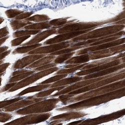 NBR1 Antibody, Novus Biologicals 0.1 mL | Buy Online | Novus Biologicals | Fisher Scientific