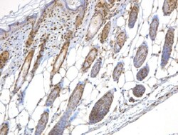 Nbs1 Antibody - BSA Free, Novus Biologicals:Antibodies:Primary Antibodies