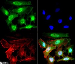 Nbs1 Antibody (7E4A2), Novus Biologicals:Antibodies:Primary Antibodies