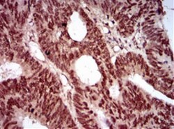 Nbs1 Antibody (7E4A2), Novus Biologicals:Antibodies:Primary Antibodies