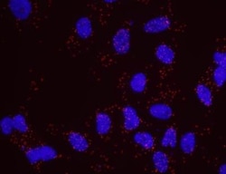 Nbs1 Antibody, Novus Biologicals 0.1mL; Unlabeled:Antibodies, Polyclonal