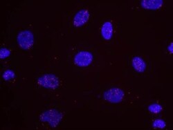 Nbs1 Antibody, Novus Biologicals 0.1mL; Unlabeled:Antibodies, Polyclonal