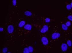 Nbs1 Antibody, Novus Biologicals 0.1mL; Unlabeled:Antibodies, Polyclonal