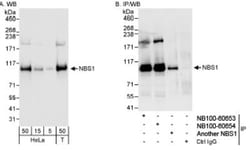 Nbs1 Antibody, Novus Biologicals 0.1mL; Unlabeled:Antibodies, Polyclonal