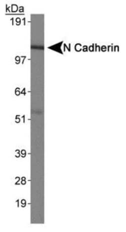 N-Cadherin Antibody (13A9), Novus Biologicals:Antibodies:Primary Antibodies