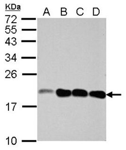 NCALD Antibody, Novus Biologicals 0.1 mL | Buy Online | Novus Biologicals | Fisher Scientific