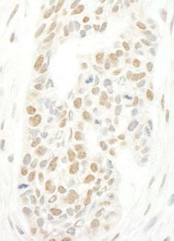 NCAPH2 Antibody, Novus Biologicals 0.1mg; Unlabeled:Antibodies, Polyclonal