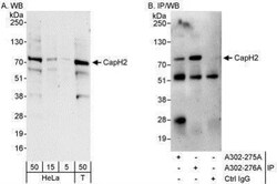 NCAPH2 Antibody, Novus Biologicals 0.1mg; Unlabeled:Antibodies, Polyclonal