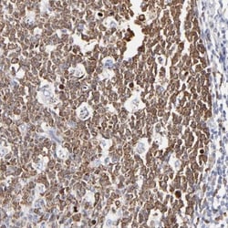 NCAPH Antibody, Novus Biologicals:Antibodies:Primary Antibodies