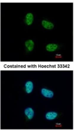 NCBP1 Antibody, Novus Biologicals 0.1mL; Unlabeled:Antibodies, Polyclonal