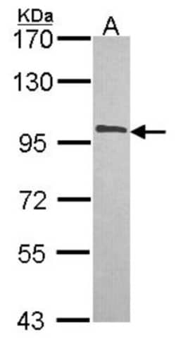 NCBP1 Antibody, Novus Biologicals 0.1mL; Unlabeled:Antibodies, Polyclonal