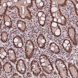 anti-NCBP1, Polyclonal, Novus Biologicals 0.1 mL | Buy Online | Novus Biologicals | Fisher Scientific