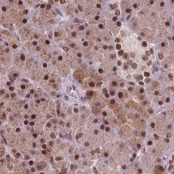 anti-NCBP1, Polyclonal, Novus Biologicals 0.1 mL | Buy Online | Novus Biologicals | Fisher Scientific