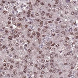 anti-NCBP1, Polyclonal, Novus Biologicals 0.1 mL | Buy Online | Novus Biologicals | Fisher Scientific