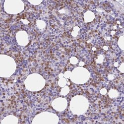 NCF1 Antibody, Novus Biologicals 25 &mu;L, Unlabeled:Antibodies, Polyclonal