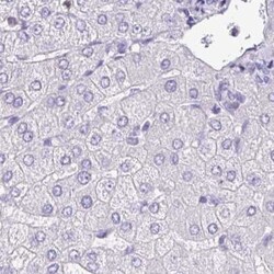 NCF1 Antibody, Novus Biologicals 25 &mu;L, Unlabeled:Antibodies, Polyclonal