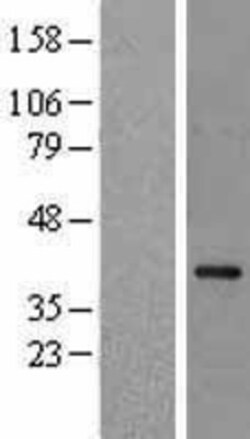 Novus Biologicals&trade;&nbsp;NCF4 Overexpression Lysate