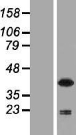 Novus Biologicals&trade;&nbsp;NCF4 Overexpression Lysate