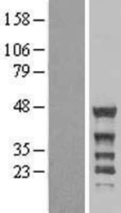 Novus Biologicals&trade;&nbsp;NCK2 Overexpression Lysate