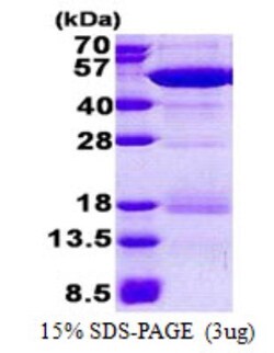 Novus Biologicals&trade;&nbsp;Recombinant Human NCK2 His Protein
